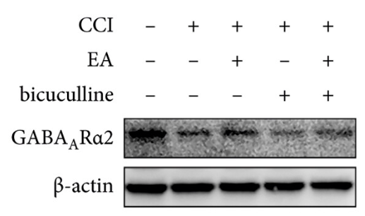 GABRA2 Antibody - Figure 3.