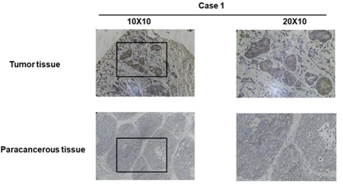 CENPN Antibody - Fig.