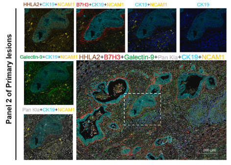 HHLA2 Antibody - Fig.