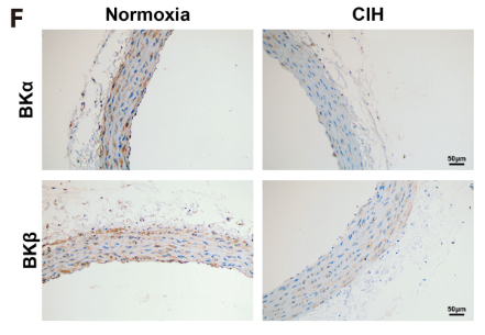 KCNMB1 Antibody - Fig.