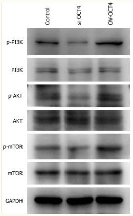 Phospho-PI3K p85 (Tyr458)[Tyr467]/p55 (Tyr199) Antibody - Figure 6.