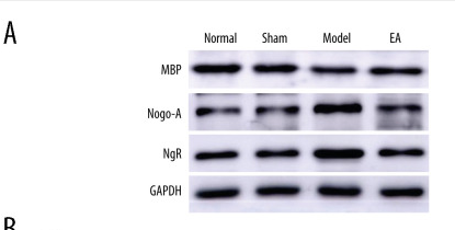 Myelin Basic Protein/MBP Antibody - Figure 3.