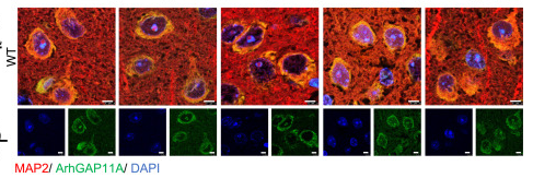ARHGAP11A Antibody - Figure 1 The levels of ArhGAP11A are significantly increased in patients with AD and APP/PS1 mice A) The relative mRNA levels of ArhGAP11A in the hippocampus of patients with AD and healthy aging people (control [Con]) were analyzed.