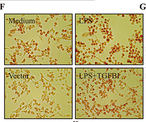 TGFBI Antibody - Figure 6 Exploring the potential functions of TGFBI.