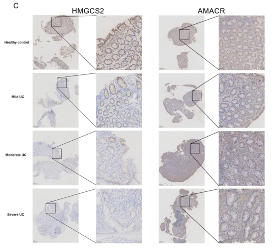 AMACR Antibody - Fig.