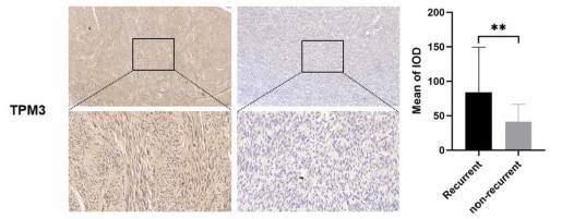 TPM3 Antibody - Fig.