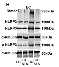 Phospho-NLRP3 (Ser194) Antibody - Figure 2 STS inhibits the activation of NLRP3 inflammasome in diabetic aortas, HG-treated ECs and VSMCs.