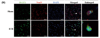Daxx Antibody - FIGURE 2 ICH promoted endogenous levels of RIPK3, AIF, DAXX, MLKL, and p-MLKL in mice.