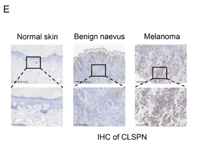Claspin Antibody - Fig.