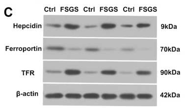 HAMP Antibody - Figure 4 FSGS rats showed iron metabolism disorder.