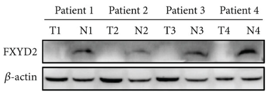 FXYD2 Antibody - Figure 2.