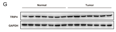 TRIP4 Antibody - Figure 4.