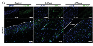 TSPO Antibody - Figure 6 Histological and western blot analyses confirm the temporal changes of tissue FAP levels during AAA progression.
