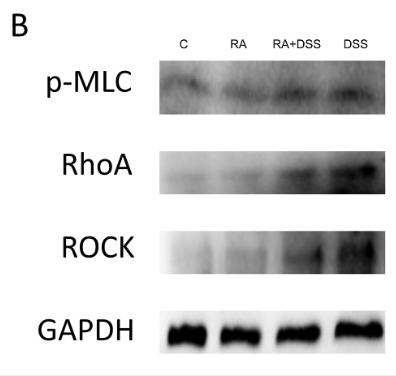 Phospho-MLC2 (Ser15) Antibody - Fig 8 Effects of RA on smooth muscle contraction of DSS-molded mice.