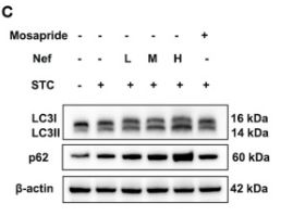 SQSTM1/p62 Antibody - Fig.