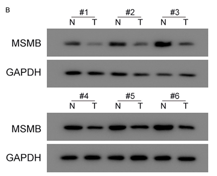 MSMB Antibody - Figure 4.