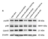 Phospho-p38 MAPK (Thr180/Tyr182) Antibody - Figure 6 The upregulation of Cdc42 in podocytes increased the Cdc42 expression and the p-p38/p38 ratio in β-TC6 cells, which were accompanied by an increase in malondialdehyde (MDA) levels and a decrease in SOD activity.
