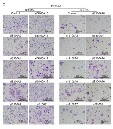 S100A16 Antibody - Fig.