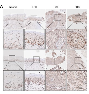 Seladin 1 Antibody - Figure 7.