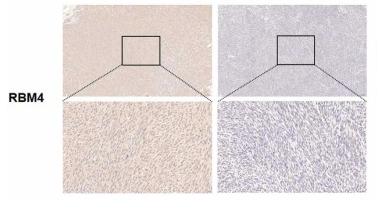 RBM4 Antibody - Fig.