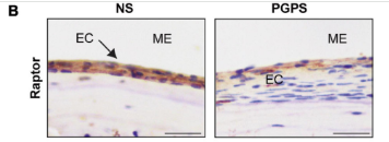 Raptor Antibody - Figure 3.