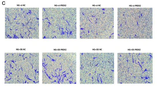 Peroxiredoxin 2 Antibody - Figure 3 Effect of PRDX2 on proliferation, migration, and apoptosis of NHDF cells.
