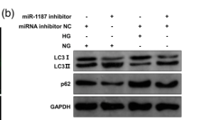 Phospho-SQSTM1/p62 (Ser403) Antibody - Figure 4.