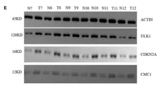 CDKN2A/p16INK4a Antibody - Figure 8 mRNA and protein relative expression of genes in the risk model.