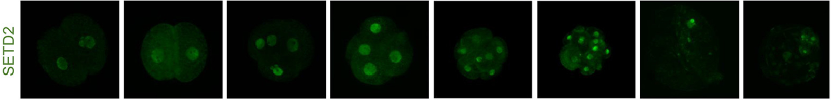 SETD2 Antibody - Figure 3.