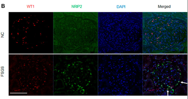 NRIP2 Antibody - FIGURE 1.