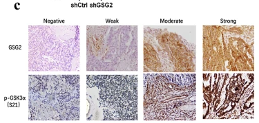 Phospho-GSK3 alpha (Ser21) Antibody - Fig.