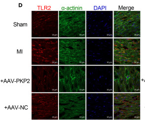 TLR2 Antibody - Figure 6 PKP2 is an upstream regulator of TLR2/TLR4/Nav1.