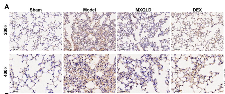 HDAC7 Antibody - Figure 4.