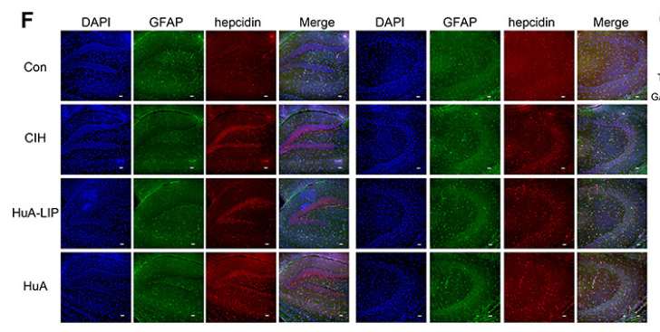 HAMP Antibody - Figure 5 Iron levels in the hippocampus of CIH mice.