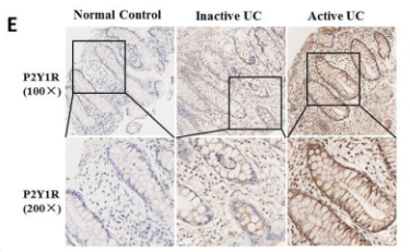 P2RY1 Antibody - Figure 3.