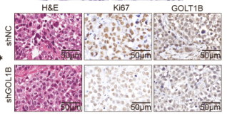 GOLT1B Antibody - Figure 2GOLT1B enhances CESC cell proliferation and migration in vitro and in vivo.