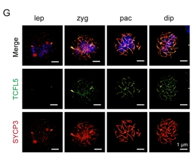 TCFL5 Antibody - Fig.