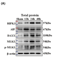 Daxx Antibody - FIGURE 2 ICH promoted endogenous levels of RIPK3, AIF, DAXX, MLKL, and p-MLKL in mice.