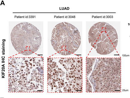 KIF20A Antibody - FIGURE 7.