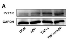 P2RY1 Antibody - Figure 3.