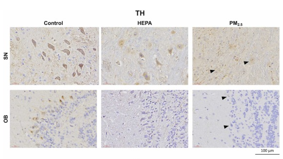 Tyrosine Hydroxylase Antibody - Fig.