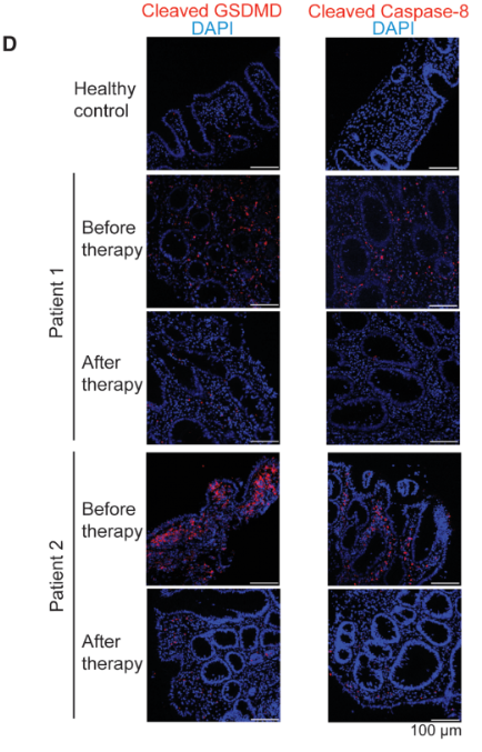 Cleaved-Caspase 8 (Asp384) Antibody - Figure 1.
