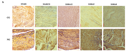 S100A12 Antibody - Figure 6 Comparison of differentially expressed genes (DEGs) of macrophage (Mac) subclusters in two groups (NG and CG) and partial DEGs were verified.