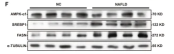 SREBP1 Antibody - FIGURE 6.