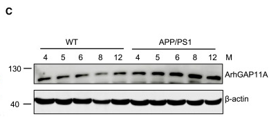 ARHGAP11A Antibody - Figure 1 The levels of ArhGAP11A are significantly increased in patients with AD and APP/PS1 mice A) The relative mRNA levels of ArhGAP11A in the hippocampus of patients with AD and healthy aging people (control [Con]) were analyzed.