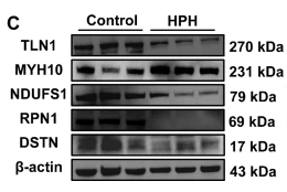 DSTN Antibody - Fig.