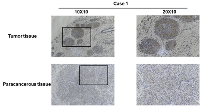 CENPN Antibody - Fig.