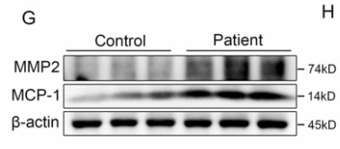 MCP1 Antibody - Fig.