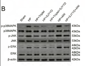 Phospho-ERK1/2 (Thr202/Tyr204) Antibody - Figure 3.