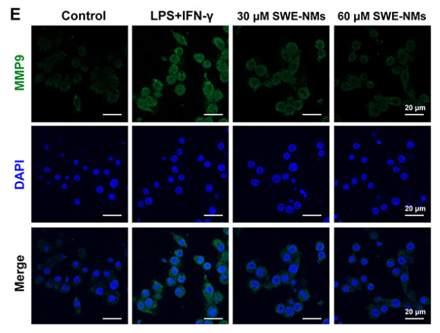 MMP9 Antibody - Figure 9 The effects of SWE-NMs on expression of EGFR (A and B), JNK (C and D) and MMP9 (E and F).